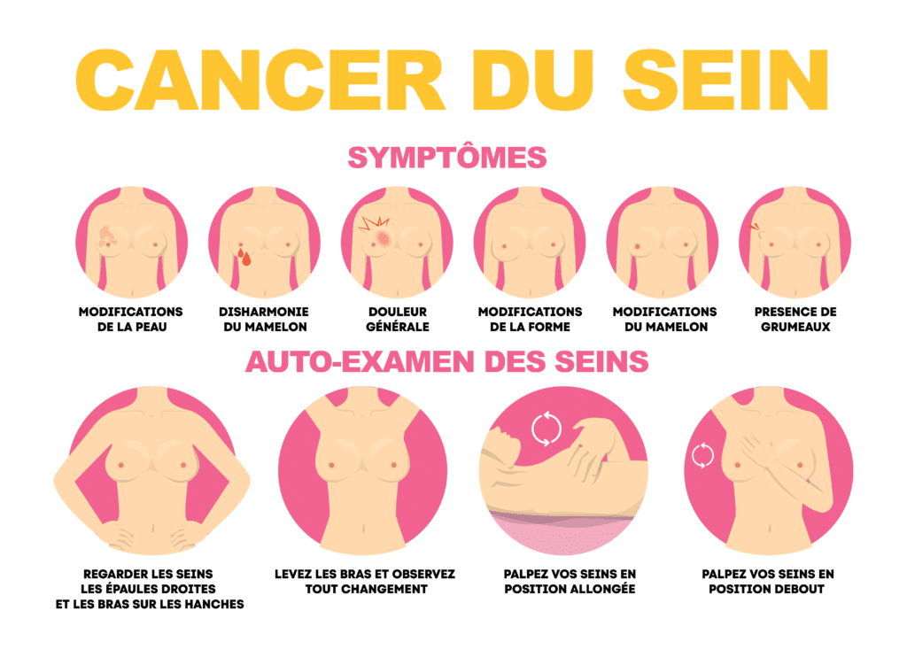 Comment se manifeste un cancer du sein ? - Physio Sahifa